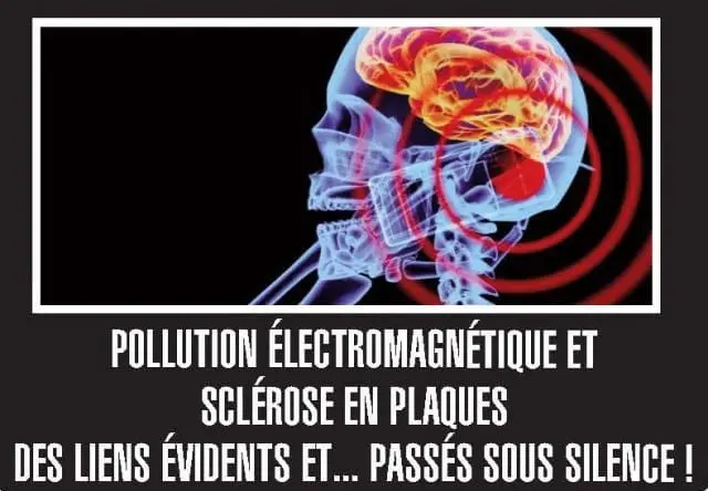 Sclérose-en-plaques-et-pollution-électromagnétique-santecool
