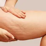Comment marchent les crèmes minceurs?