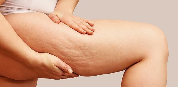 Comment marchent les crèmes minceurs?