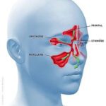 Soignez votre sinusite avec l’étiopathie