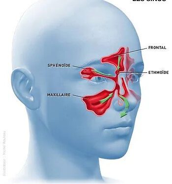 Soignez votre sinusite avec l’étiopathie