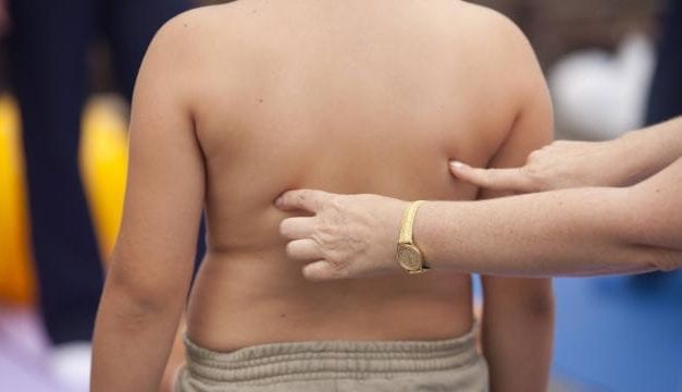 Obésité : manger moins ne fait pas perdre de graisse