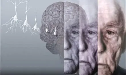 Maladie d’Alzheimer et maladies apparentées, un diagnostic tôt s’impose