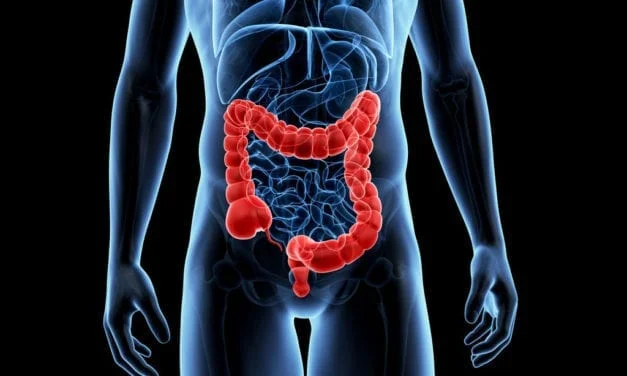Cancer colorectal, la génétique au service de la prévention et du dépistage précoce