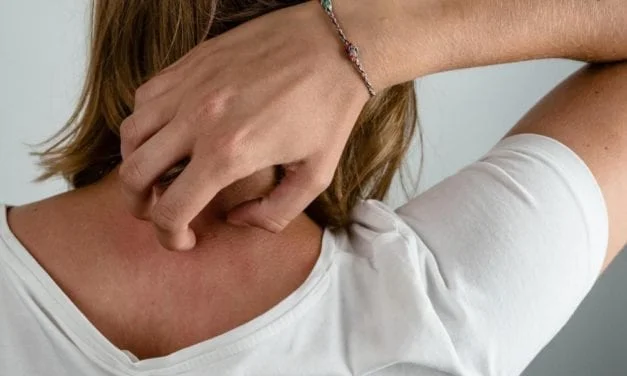 Allergies cutanées, il faut diminuer les substances chimiques dans les textiles