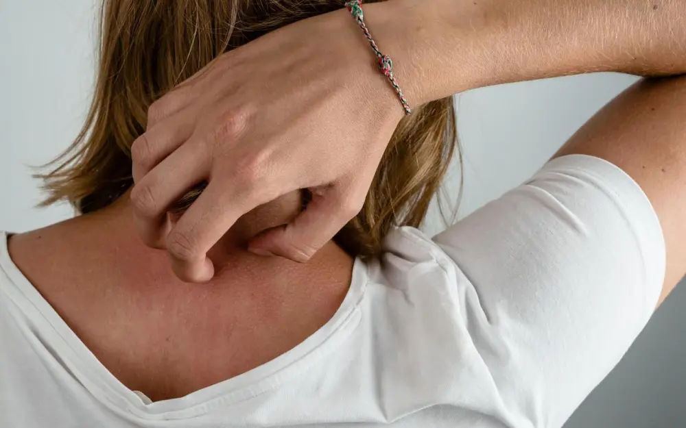 Allergies cutanées, il faut diminuer les substances chimiques dans les textiles