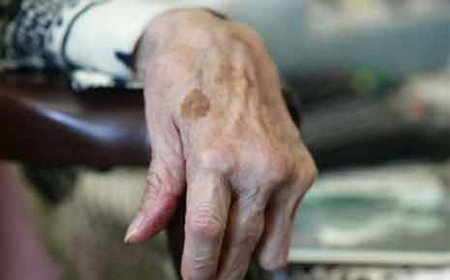 Faut-il soigner les patients très âgés comme les autres ?