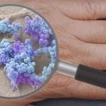 Le microbiome cutané