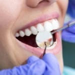 Comment prévenir les caries ?