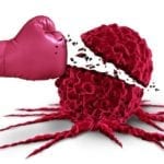 La survie globale des femmes atteintes d’un cancer du sein métastatique triple négatif améliorée grâce à l’immunothérapie