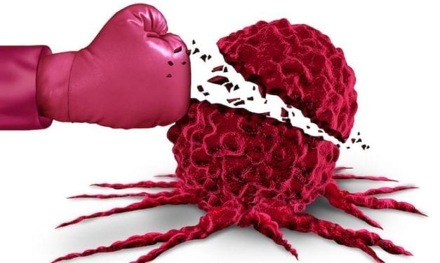 La survie globale des femmes atteintes d’un cancer du sein métastatique triple négatif améliorée grâce à l’immunothérapie