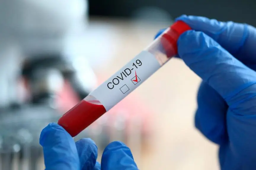 Covid-19 : Pourquoi tester? Qui tester? Comment tester?