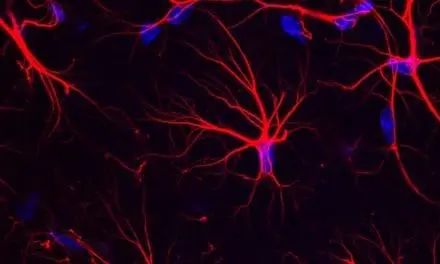Alzheimer : un acide aminé pour aider à restaurer la mémoire ?
