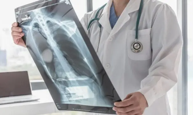 Les dernières innovations en matière de radiologie