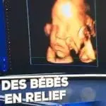 L’échographie 3D en relief : une révolution pour les non-voyants