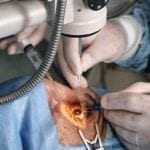 Chirurgie de la cataracte, l’anesthésie locale suffit