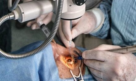 Chirurgie de la cataracte, l’anesthésie locale suffit
