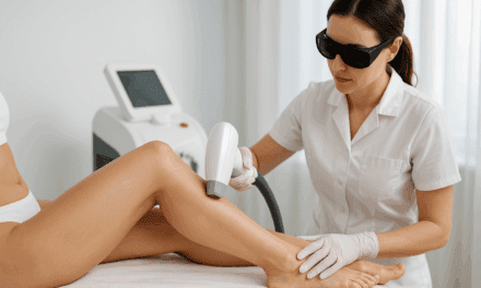 Épilation laser : est-elle efficace, accessible et à quel prix ?