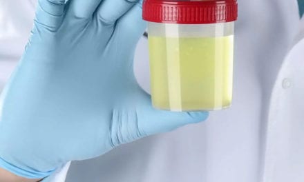 Une toxine à l’origine de dommages à l’ADN retrouvée chez des patients souffrant d’infections urinaires