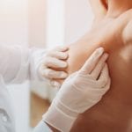Cancer du sein : des prothèses personnalisées
