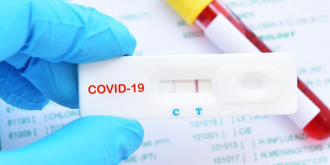 Un nouveau test sérologique pour étudier la progression de la pandémie de Covid-19