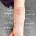 Comment diagnostiquer les allergies ?