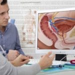 Une nouvelle combinaison de traitements contre le cancer de la prostate