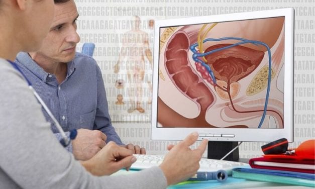 Une nouvelle combinaison de traitements contre le cancer de la prostate
