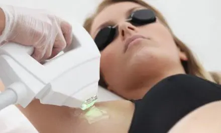 Mieux encadrer l’épilation à la lumière pulsée pour protéger les consommateurs