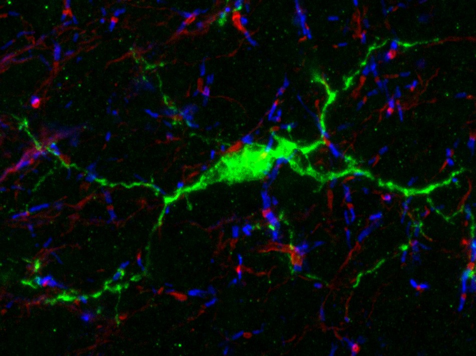 Une image en tissu fixé de cervelet de souris adulte, avec une cellule microgliale en vert contactant des nœuds de Ranvier en rouge, avec les paranœuds (zone d’ancrage de l’extrémité des couches de myéline, de part et d’autre du nœud) en bleu. © Inserm/Desmazieres Anne