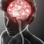 Épilepsie vaincre les préjugés