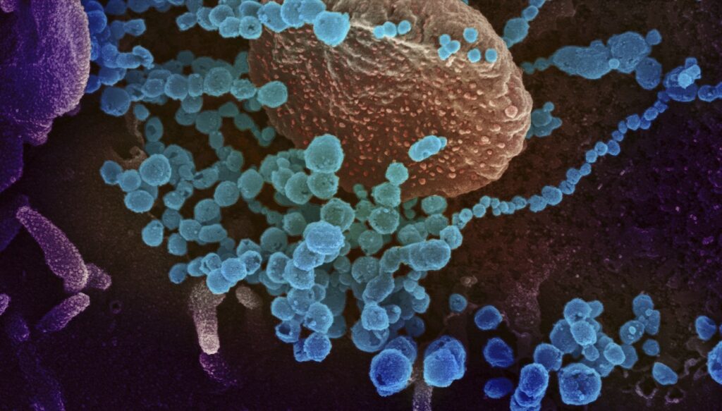 covid-19-comprendre-le-role-de-certains-globules-blancs-dans-la-reponse-immunitaire