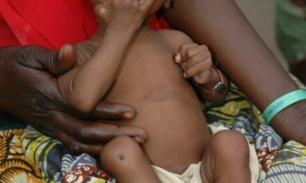 Malnutrition infantile : succès d’une nouvelle stratégie pour soigner plus d’enfants à moindre coût