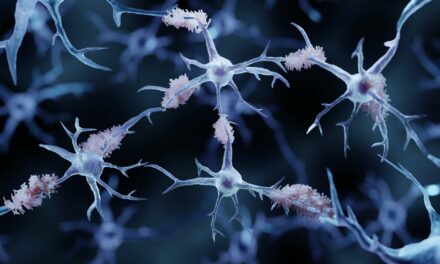 Maladie d’Alzheimer : 75 facteurs de risques génétiques identifiés