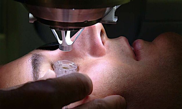 Tout savoir sur la chirurgie réfractive