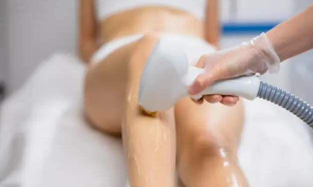 Comment fonctionne l’épilation laser ?