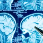 Recherche en psychiatrie un effort sans précédent