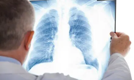 Comment diagnostiquer précocement le cancer du poumon