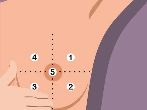 Autopalpation mammaire