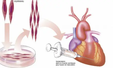 Greffe de cellules souches dans le cœur