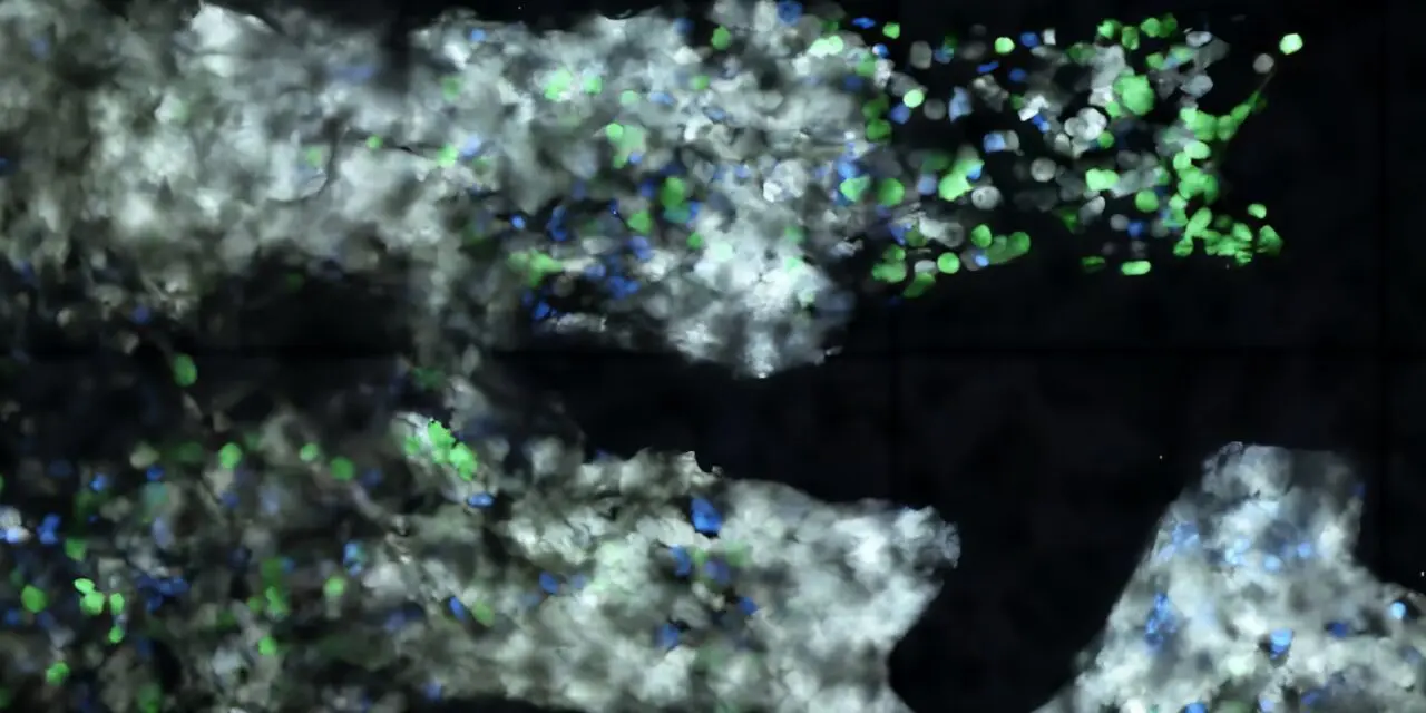 Destruction à distance des cellules cancéreuses : effet des immunothérapies dans les cancers du sang