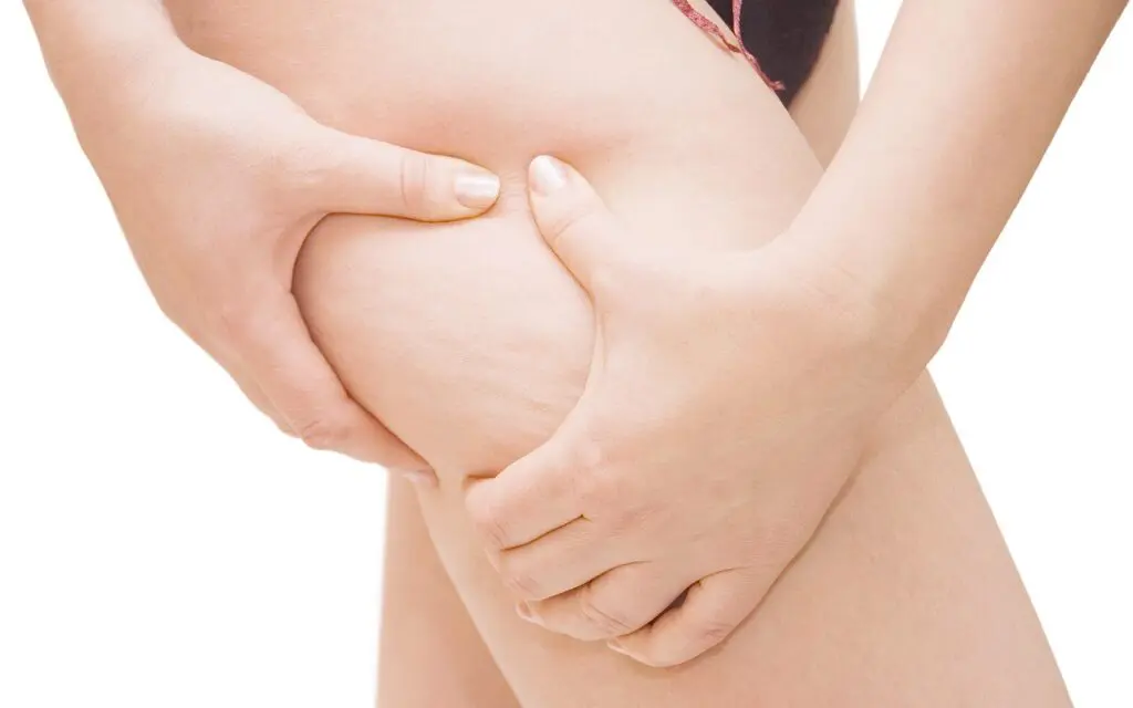 Lutter naturellement contre la rétention d’eau