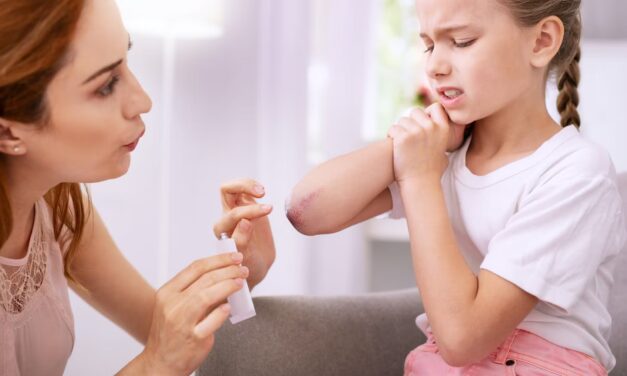 Les bienfaits de l’arnica : une plante précieuse pour notre bien-être