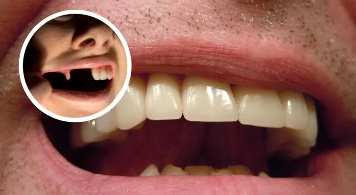 Révolution dentaire : faire repousser vos dents sera bientôt possible