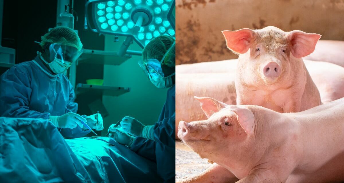 Un rein de porc fonctionne dans un corps humain depuis plus d’un mois après la greffe