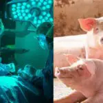 Un rein de porc fonctionne dans un corps humain depuis plus d’un mois après la greffe