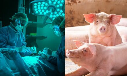 Un rein de porc fonctionne dans un corps humain depuis plus d’un mois après la greffe