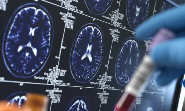 Un champignon provoquerait la Maladie d’Alzheimer