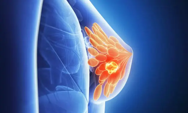 Traitement révolutionnaire contre le cancer du sein : un formidable espoir pour les patients
