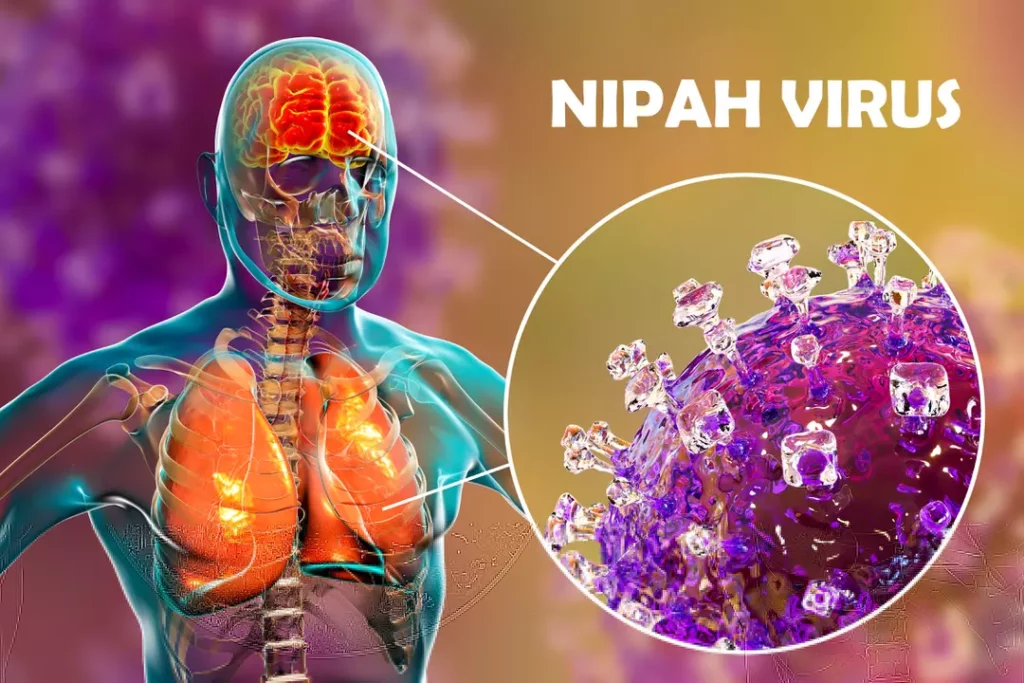 le-virus-nipah-prochaine-pandemie-a-lhorizon